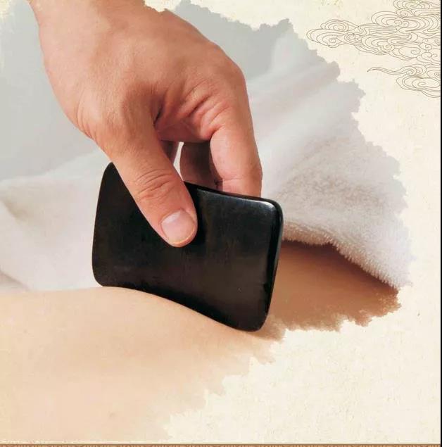 平衡火罐 平衡火罐是以罐为工具,用热力排除玻璃罐内的气体形成负压